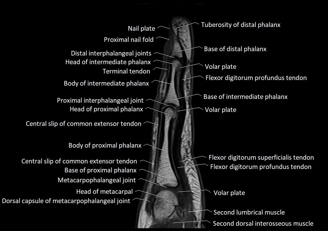 Finger anatomy sagittall cross section 3T image 5.webp